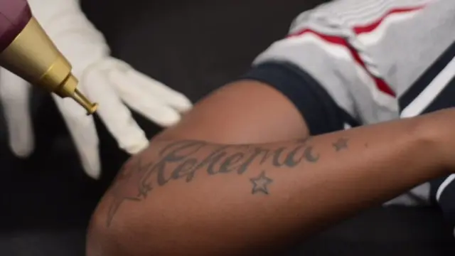 Gucci akitolewa tattoo na mashine ya Laser