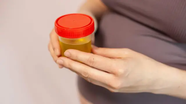 ਯੂਟੀਆਈਜ਼