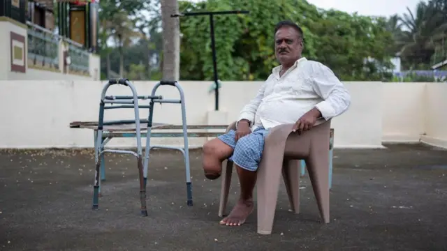 పాముకాటు వల్ల కాలును కోల్పోయిన దేవేంద్ర