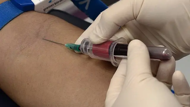 การเจาะเพื่อเอาตัวอย่างเลือดไปศึกษา