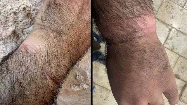 Filistinli aktivist Issa Amro BBC'ye yaptığı açıklamada, 7 Ekim'de IDF tarafından gözaltına alındığında ellerinin sıkı bağlandığını ve bunun kan dolaşımını kestiğini söyledi