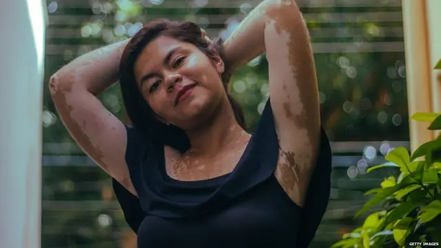 પાડુંરોગ