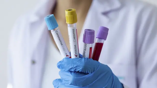 Test için alınan örnekler (Arşiv fotoğrafı).