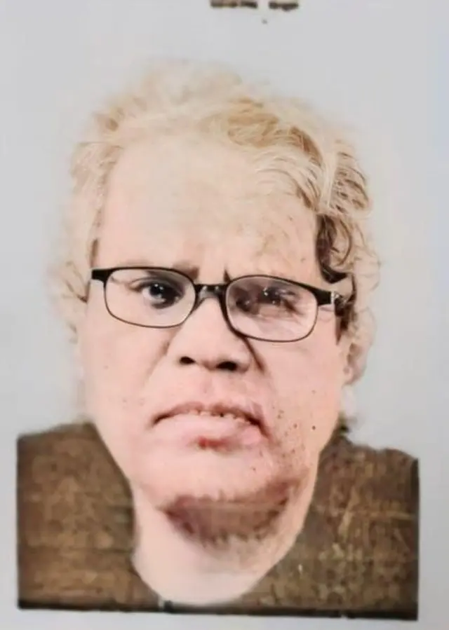 ભોપાલ દામો મધ્ય પ્રદેશ નકલી હાર્ટ સર્જન સાત લોકોનાં મૃત્યુ, મિશન હૉસ્પિટલ, મધ્ય પ્રદેશના મુખ્ય મંત્રી, કાર્ડિયૉલૉજિસ્ટ એન. જૉન કૅમ, વિદેશમાં ભણેલા, પ્રયાગરાજમાં ધરપકડ, રાષ્ટ્રીય માનવાધિકાર પંચ દ્વારા તપાસ, મુખ્ય મંત્રી યોગી આદિત્યનાથ ટ્વિટ, બીબીસી ગુજરાતી, બીબીસી ન્યૂઝ ગુજરાતી 