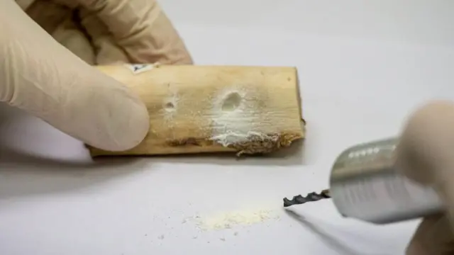 एक पीड़ित की हड्डियों की जांच करता पैथोलॉजिस्ट