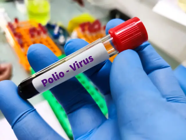 పోలియో వైరస్