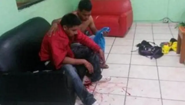 Hombre con camisa roja herido en el rostro acompañado de un amigo. 