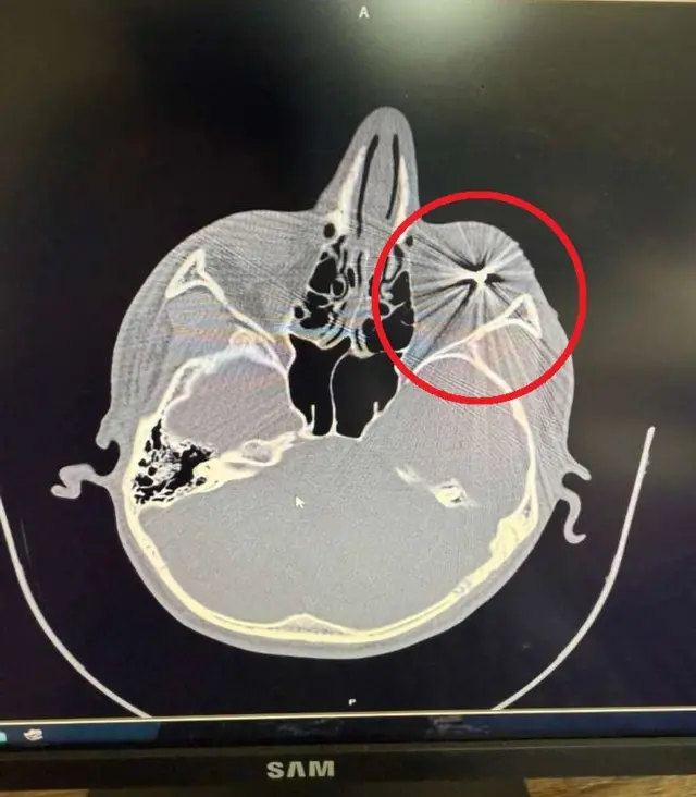 تصویر سی‌تی‌ اسکن یکی از آسیب دیدگاه چشمی مشهد که به دست بی‌بی‌سی فارسی رسیده 