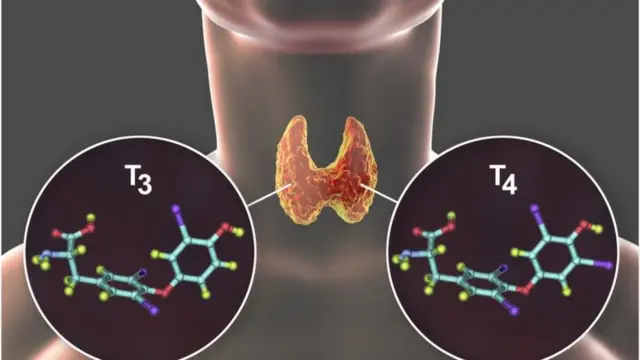 థైరాయిడ్