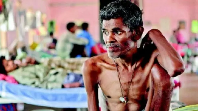 टीबी वैक्सीन, टीबी, tuberculosis vaccine