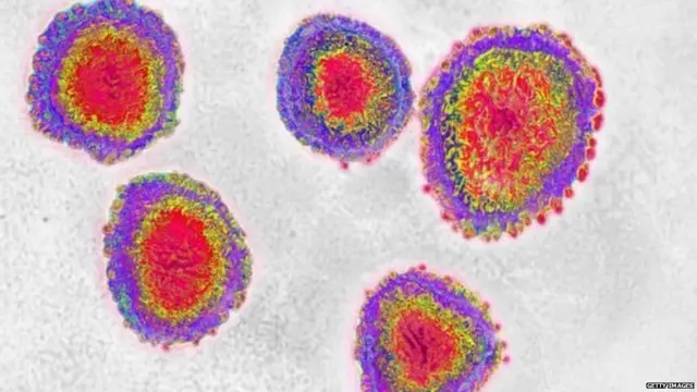 ਕੋਰੋਨਾਵਾਇਰਸ