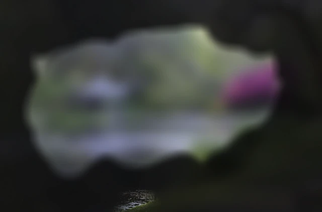 रेटिनाइटिस पिग्मेन्टोसा भनिने एलिनको अवस्थाका कारण उनले आफू वरपरको संसारको धमिलो छवि मात्र देख्छिन्