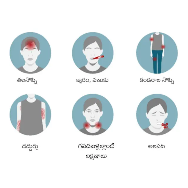 ఎంపాక్స్ లక్షణాలు