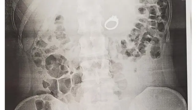 Qubellicha garaashee keessatti