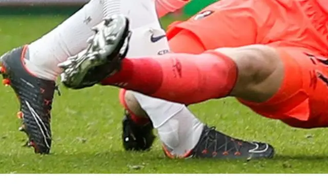 إصابة هاري كين