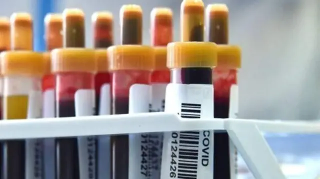 کورونا درملنه