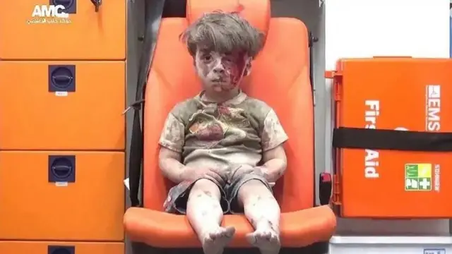 Omran Daqneesh alinusurika shambulizi la anga mwaka 2016 katika kitongoji kinachopinga utawala wa Bashar al-Assad.
