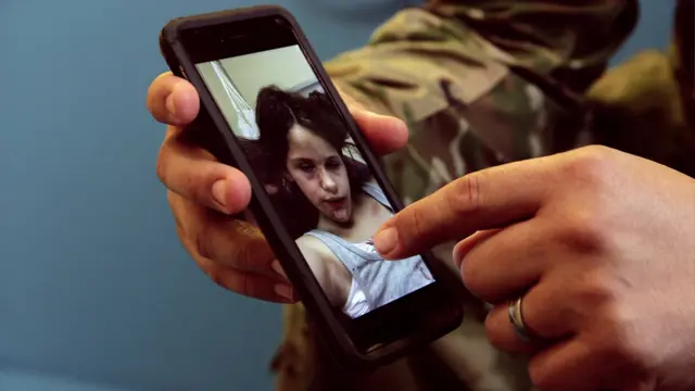 Foto de Sufija con el rostro golpeado y lleno de moretones.