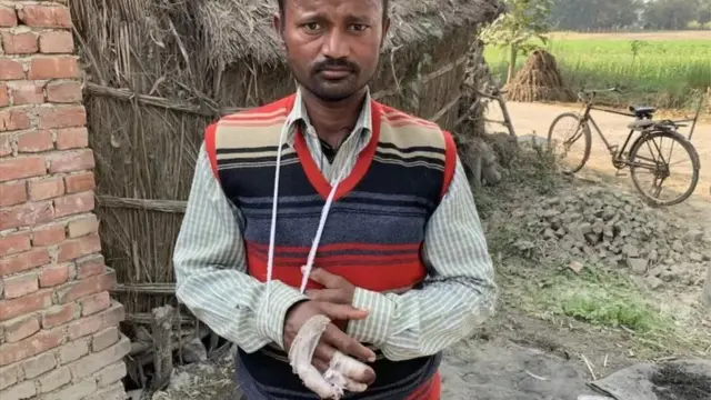 పశువుల దాడిలో గాయపడ్డ శివపూజన్