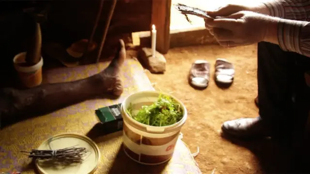 Kumeshuhudiwa visa vingi vya watu wenye albinism kuuawa kwa uchawi katika baadhi ya mataifa Afrika mashariki ikiwemo Tanzania na Burundi