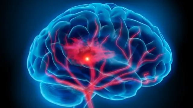 Illustration du cerveau