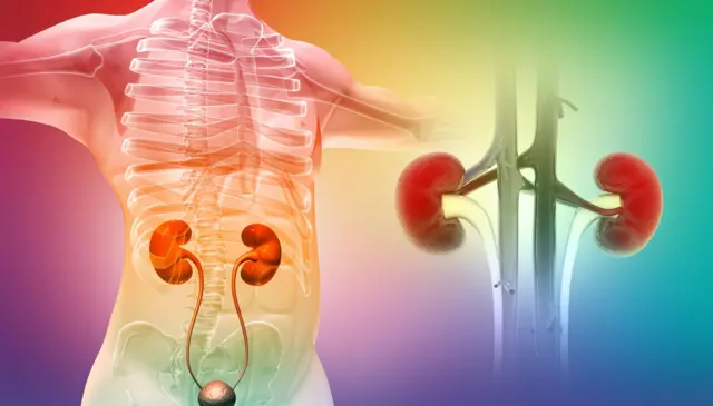 ਗੁਰਦੇ ਵਿੱਚ ਪੱਥਰੀ 