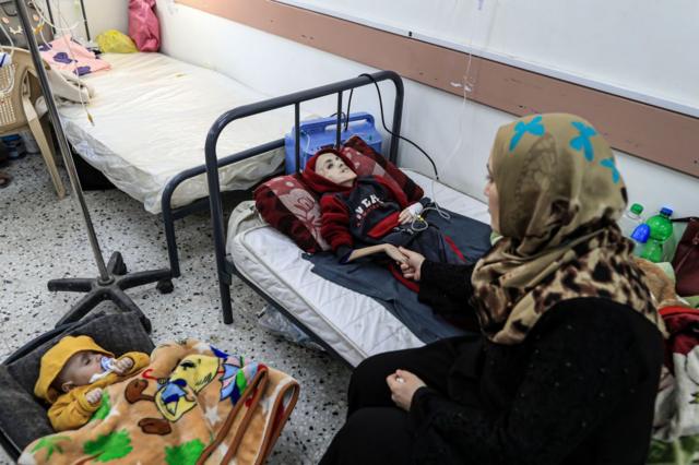 طفل فلسطيني يعاني من سوء التغذية في مستشفى في غزة