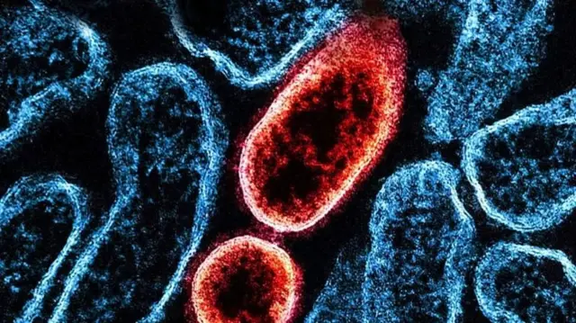 બીબીસી ગુજરાતી, ગુજરાત, બીબીસી, અમદાવાદ, પશ્ચિમ બંગાળ, નિપાહ વાઇરસ