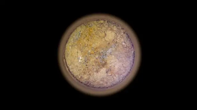 प्रातिनिधिक फोटो 