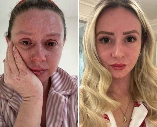 ਰੇਬੇਕਾ ਐਬੇਜ