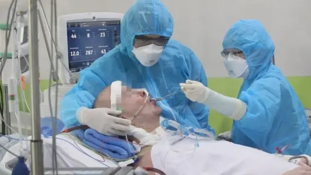 ভিয়েতনামের চো-রে হাসপাতালে অচেতন স্টিভেন ক্যামেরনকে খাওয়ানো হচ্ছে। তার ফুসফুসের কার্যক্ষমতা ১০ শতাংশে নেমে যায়