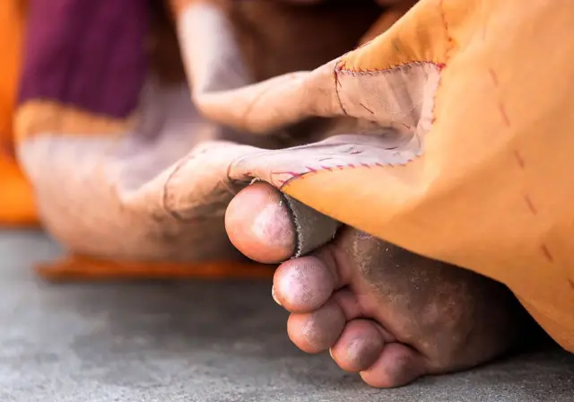 HOUSTON, TEXAS - NOVEMBER 14: The bandaged foot of a Buddhist monk is shown during a welcome ceremony for the monks from the Huong Dao Vipassana Bhavana Center in Fort Worth, who are undertaking a 2,300 mile pilgrimage of Walk for Peace, at Hong Kong City Mall in Houston Friday, Nov. 14, 2025.