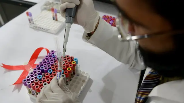 افغانستان او پاکستان کې خلک د دې ناروغۍ په اړه غږېدل شرم ګڼي