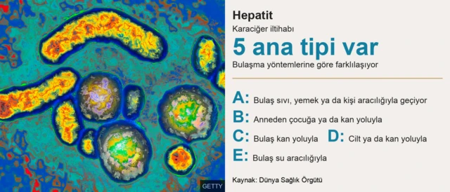 Tipleri