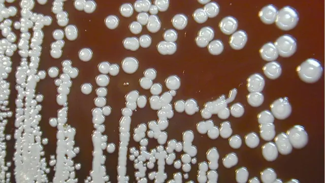 Vi khuẩn burkholderia pseudomallei sinh sôi trong máu cừu sau 72 tiếng đồng hồ.