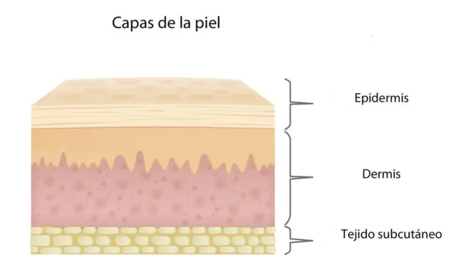 Gráfico sobre las distintas capas de la piel.