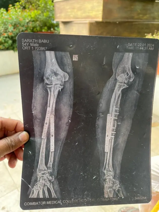 சரத்பாபு