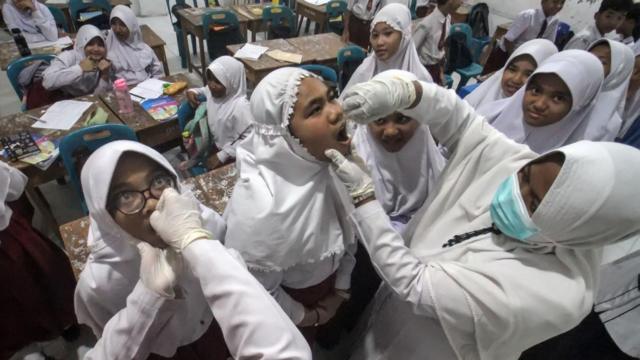 Pemberian vaksin polio di Aceh