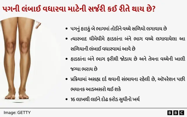 પગ લાંબા કરવાની સર્જરી