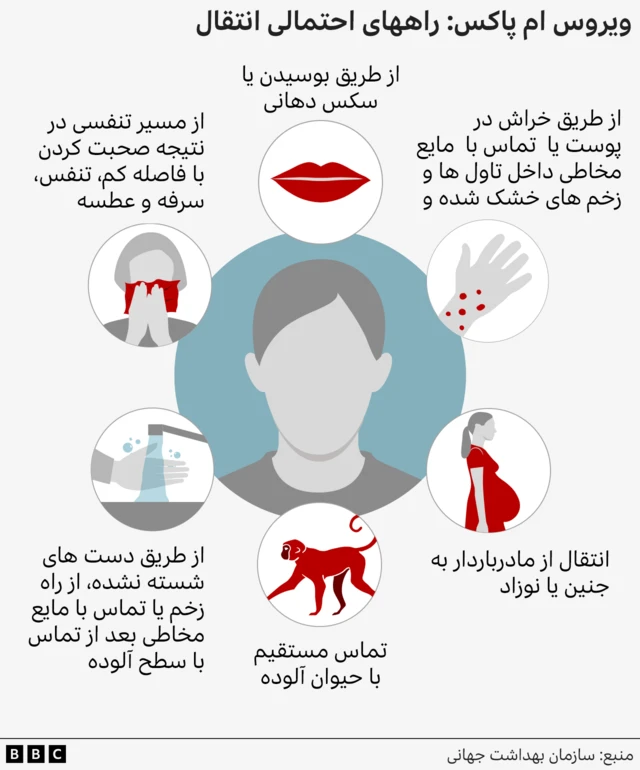 تصویرسازی از راه‌های انتقال ویروس ام‌پاکس