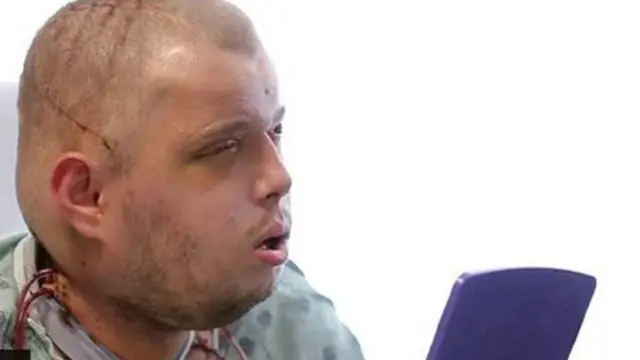 මුහුණේ බද්ධ කිරීම් මගින් රූපය ලද ගිනි නිවන භටයෙක්