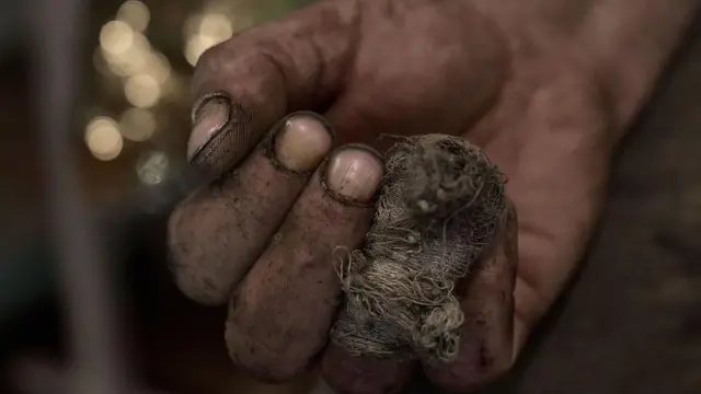 Рука пораненого військового, вона брудна із забинтованим пальцем  