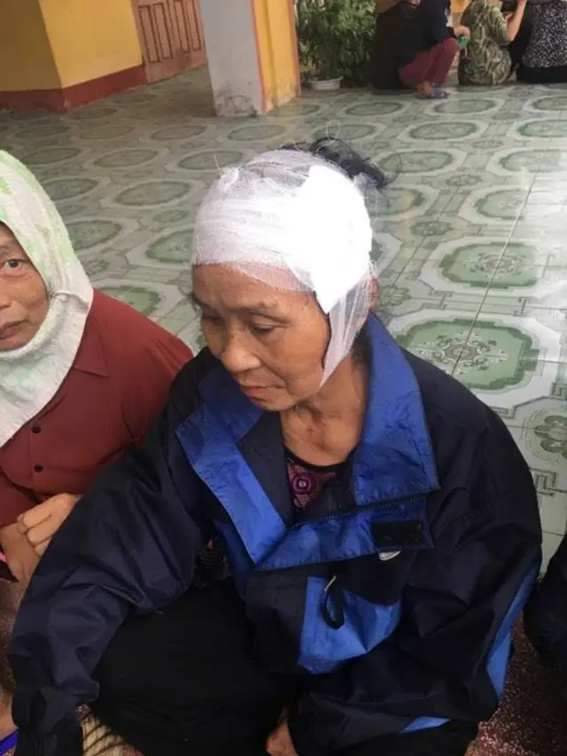 Một trong hai người dân bị đánh chảy máu đầu