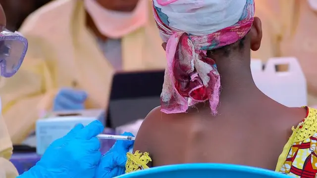 Un vaccin développé pour combattre le virus Ebola est le seul qui utilise la même technologie que les vaccins russe et Oxford-AstraZeneca contre le Covid-19.