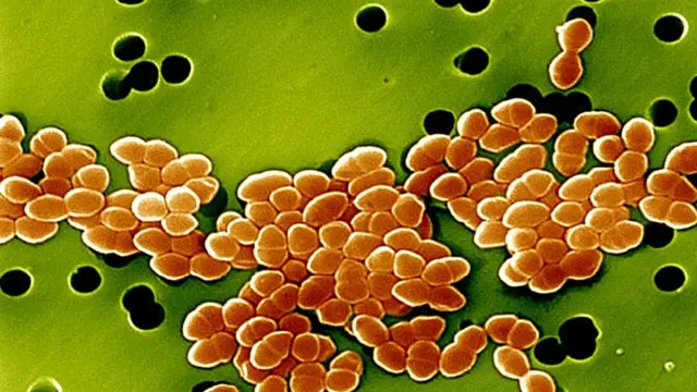 এমআরএসএ ব্যাকটেরিয়াকে সবচেয়ে প্রাণঘাতী বলে মনে করা হয়।