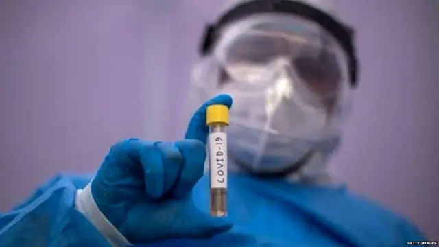 ਕੋਰੋਨਾਵਾਇਰਸ