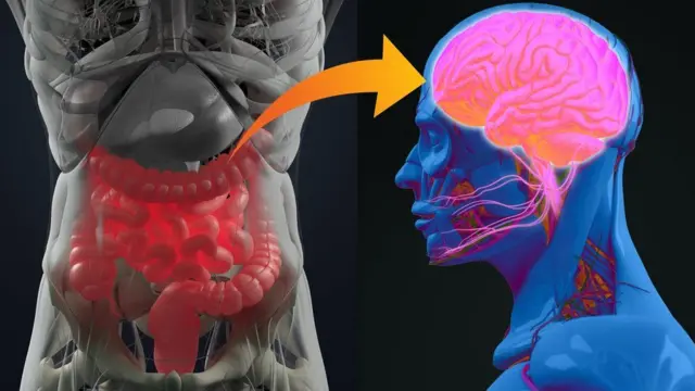 Ilustração mostra o sistema digestivo e a doença neurológica