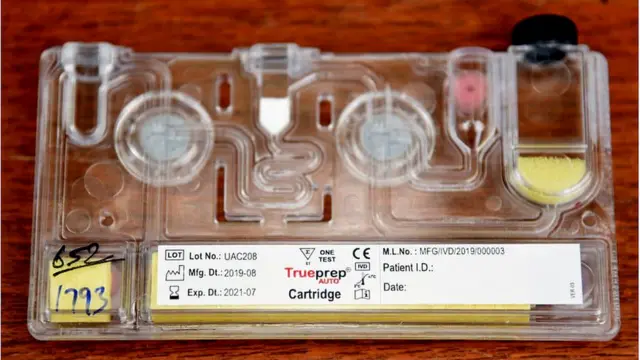 మేడిన్ ఆంధ్రప్రదేశ్ క‌రోనావైర‌స్ టెస్టింగ్ కిట్లు..