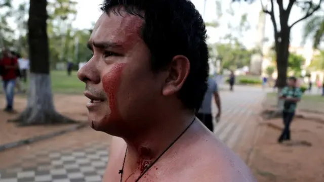 Un manifestante con sangre