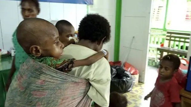 Bencana kesehatan di Asmat, Papua, telah menewaskan 71 anak, sementara 800 orang perlu mendapat pengobatan khusus.